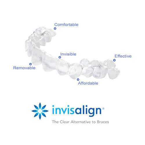 Adults and Teens Can Straighten Their Smiles with Invisalign